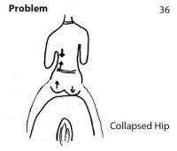 storey-Collapsing Hip: Horserider’s Problems and Solutions