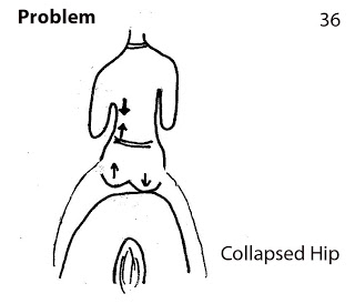 storey-Collapsing Hip: Horserider’s Problems and Solutions